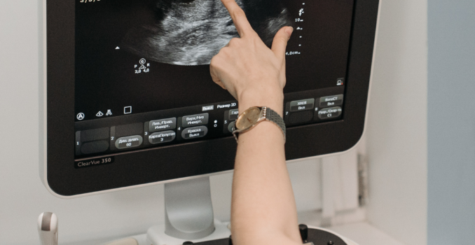 Mastering Ultrasound The Key to Diagnostic Precision